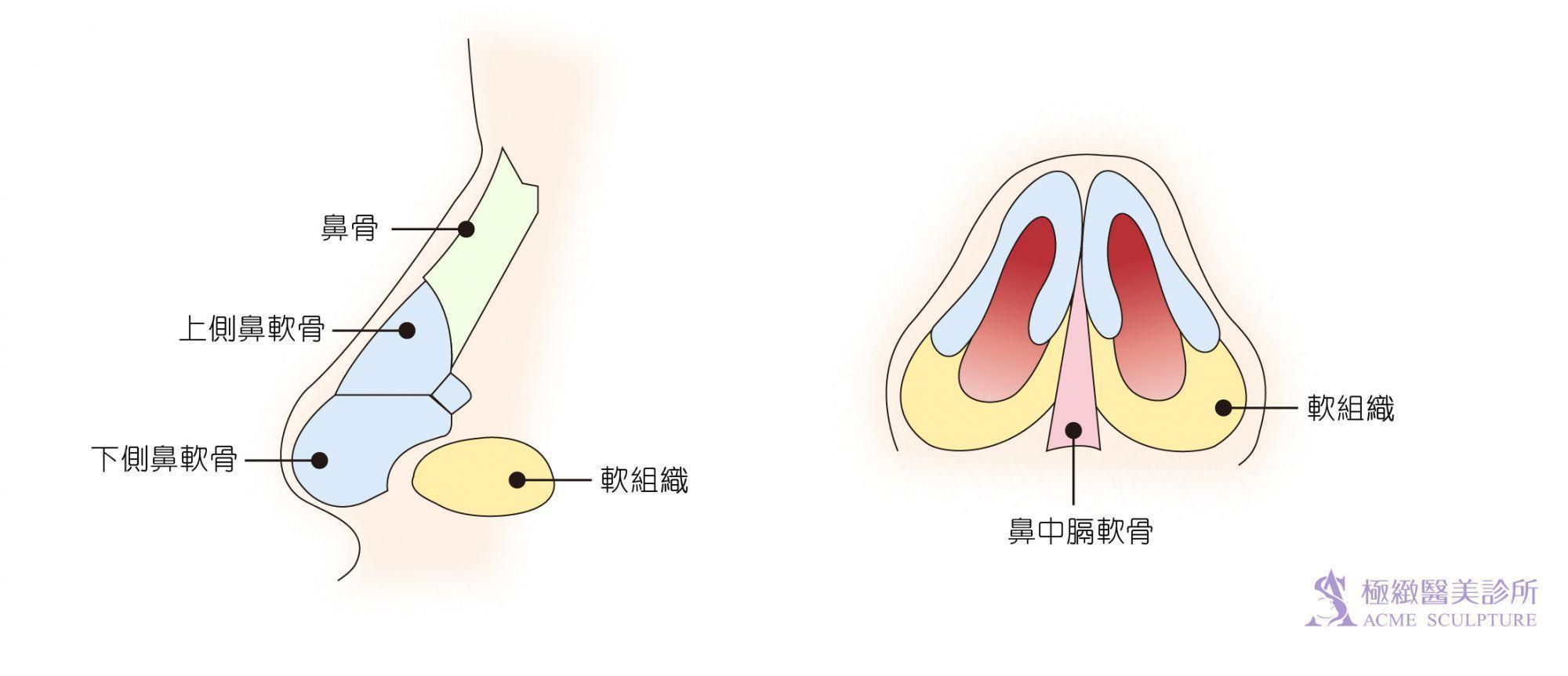 瞭解隆鼻手術如何讓鼻子變挺-極緻醫美診所