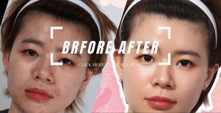 自體脂肪臉雕｜煩惱脂肪多！？告訴你如何再運用！